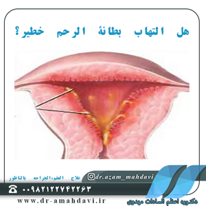 هل التهاب بطانة الرحم خطير؟