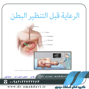 الرعاية-قبل-التنظیر-البطن